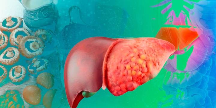 ¿Qué tipos de queso puedo comer si padezco hígado graso y cuáles debo evitar para no afectar más al órgano?