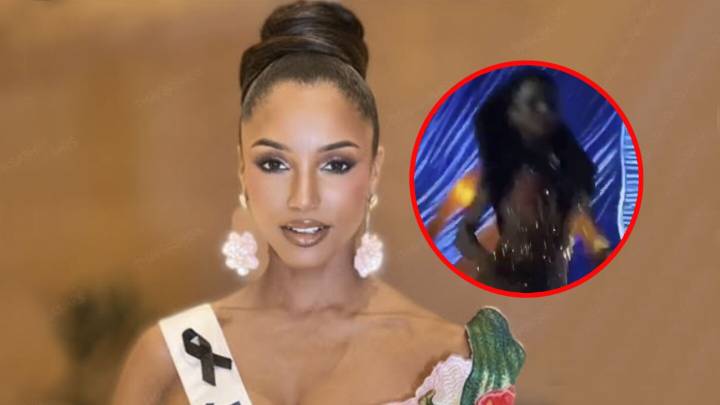 Miss Jamaica tuvo fractura y hemorragia intracraneal, sigue en estado crítico y la enviarán a su país