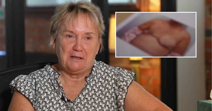 Another cancer survivor sues Virginia surgeon over breast reconstruction: 'It was done terribly'