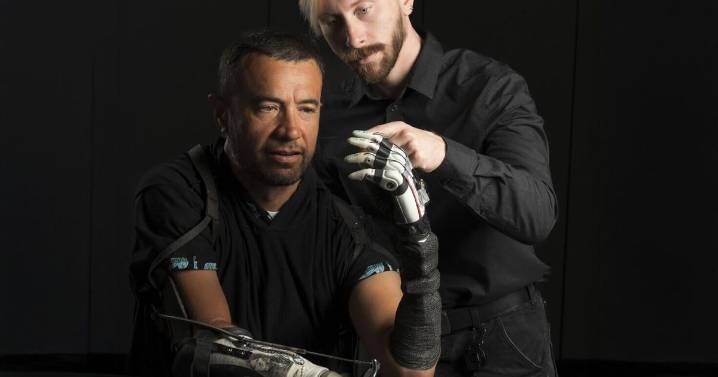 Bionic hand given AI ‘mind of its own’ to improve life of amputees