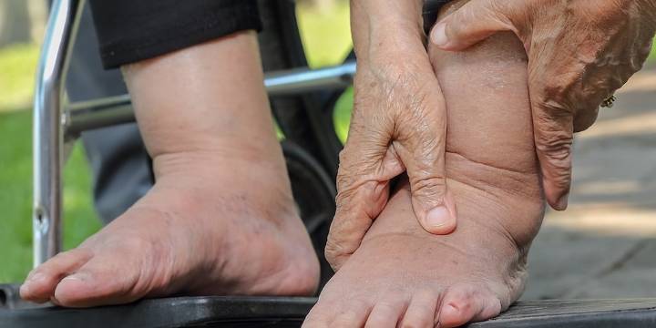 Los analgésicos comunes engañan a los médicos al diagnosticar insuficiencia cardíaca, advierte un estudio