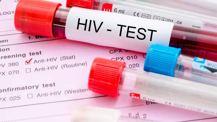 Día Mundial del VIH: por qué los contagios siguen estables a pesar de las nuevas formas de prevención