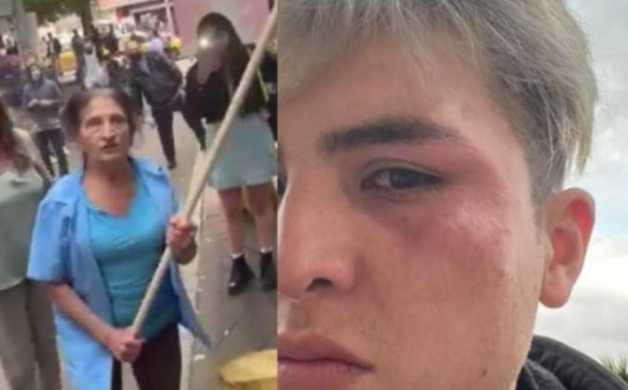 “Me golpearon, solo me defendí”: habla mujer acusada de acto homofóbico y violento en Bogotá