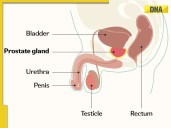 Prostate cancer explained: Key symptoms, how it’s diagnosed
