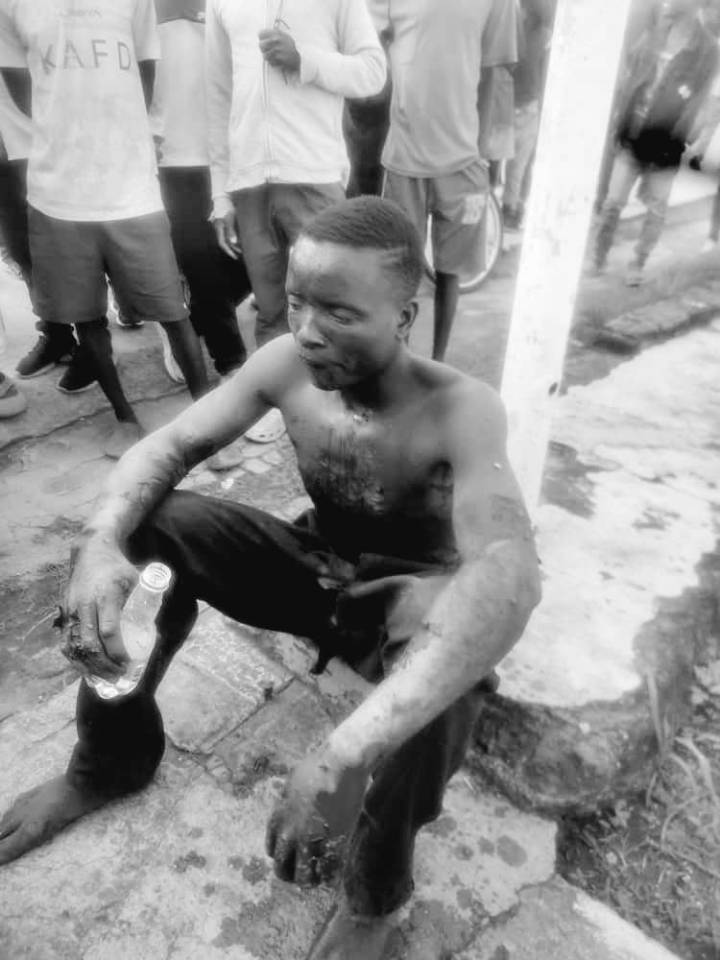 Man Electrocuted While Trying To Steal ESCOM Live Cable In Blantyre