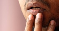 Vitamin B12 deficiency symptoms that show up in your mouth