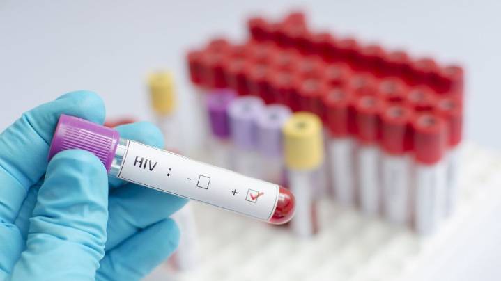 Un paciente se cura del VIH con la médula ósea de un donante solo parcialmente compatible