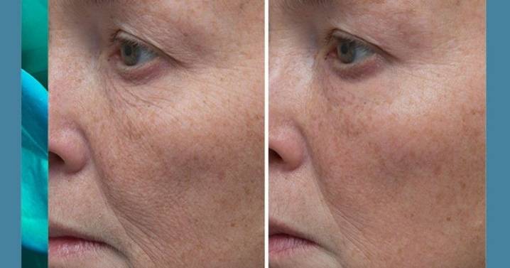 The 'best face cream on the market' that 'makes a difference to wrinkles' is £29 off