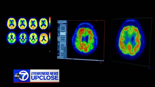 Up Close with Bill Ritter: Understanding Alzheimer's disease after NJ Sen. Andy Kim opens up about father's diagnosis