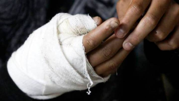 Nariño activa vigilancia intensificada por lesiones con pólvora hasta el 17 de enero