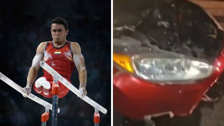 SEMANA conoció el estado de salud del gimnasta Jossimar Calvo, tras salir herido por ataque explosivo en Norte de Santander