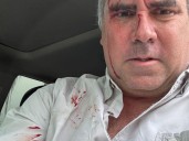 Perú: atacaron a balazos al candidato a presidente Rafael Belaúnde