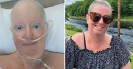 Brave breast cancer patient opens up on "pulled muscle" symptom that led to devastating diagnosis