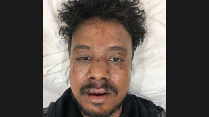 Social activist assaulted after filing complaint against illegal matka gambling