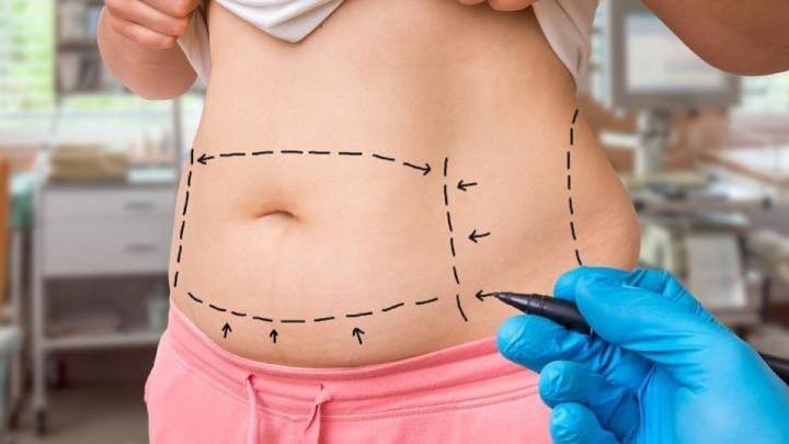 El turismo estético 'low cost' triplica las complicaciones graves y aumenta las urgencias hospitalarias