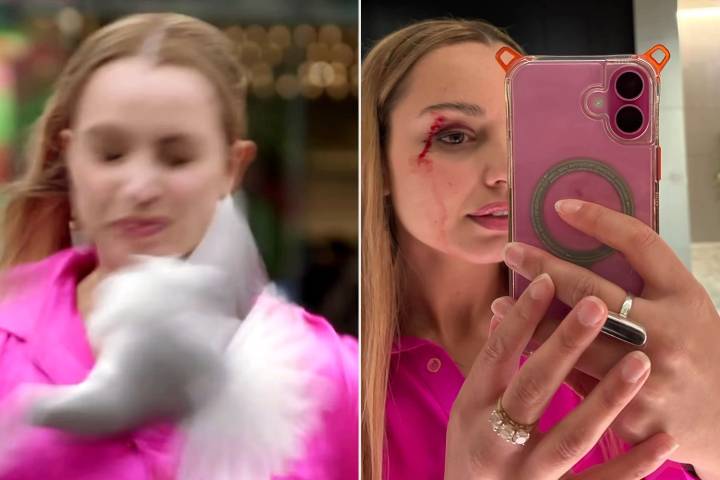 Seagull Flies Into Reporter's Face While She Films News Segment: Video