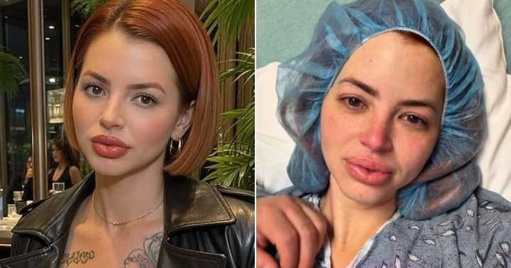 La Mariposa habla sobre su cirugía y llama a la prevención femenina