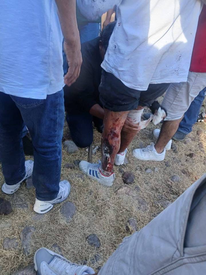 Investiga PC explosión de pirotecnia en peregrinación que dejó dos heridos