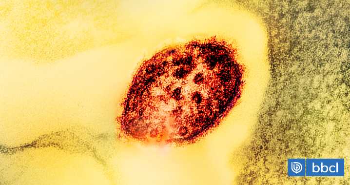 Cientos de personas están en cuarentena en Carolina del Sur por brote de sarampión y baja vacunación