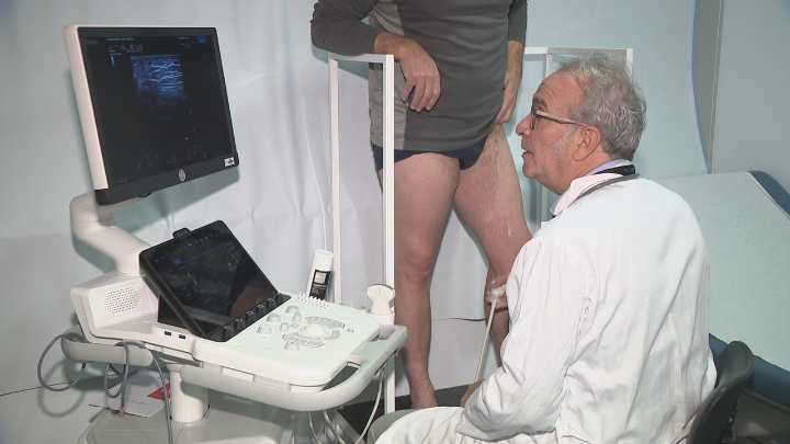 Os mitos sobre as varices: nin son cousa de mulleres nin teñen nada que ver co colesterol