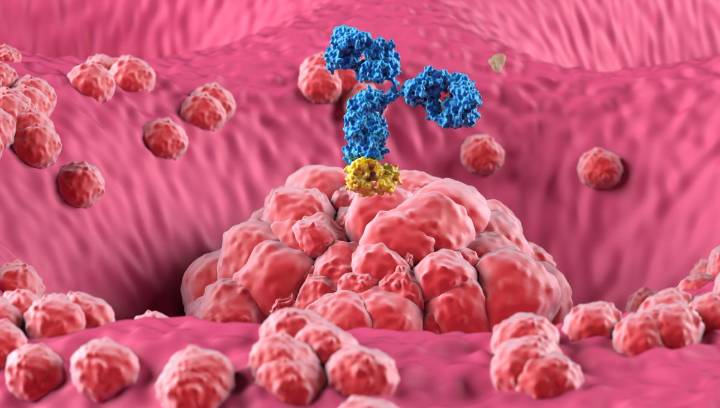 With Cancer Immunotherapy, A Morning Appointment Might Lower Your Risk Of Death By As Much As 63 Percent