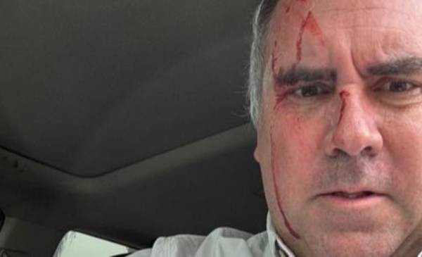 Balearon a un precandidato presidencial de Perú pero resultó ileso