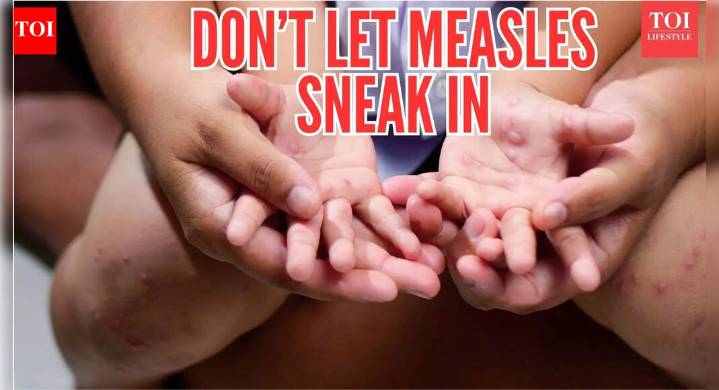 Measles outbreak in South Carolina could hit India next: Tips to stay protected