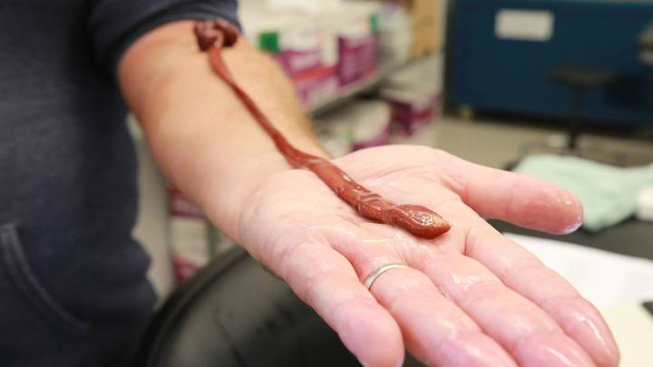 This Insanely Long Ribbon Worm Turns Out to Be The Oldest on Record