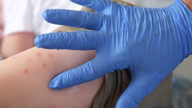 Measles exposure reported at several more schools in South Carolina