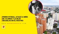 Perro pitbull atacó a niño de 10 años y le dejó secuelas en el rostro