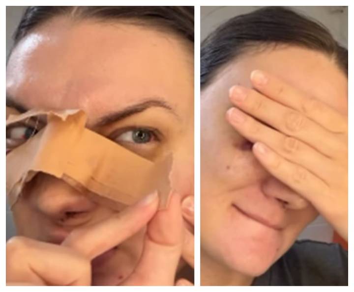 Inna Georgieva: cirugía estética, decepción y lecciones aprendidas