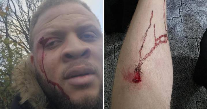 Middlesbrough cyclist injured after being hit by e