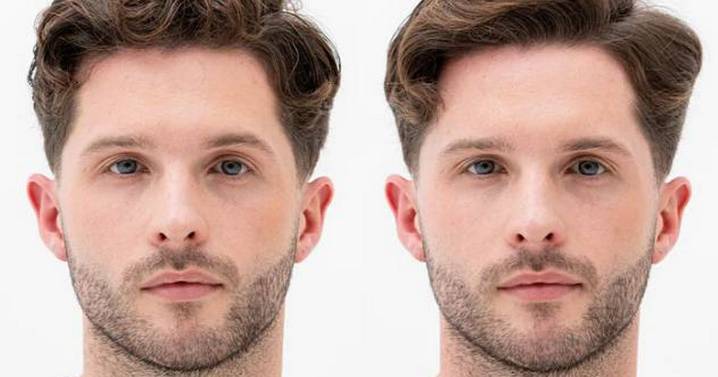 Man who 'gave up on having good hair' discovers 'game
