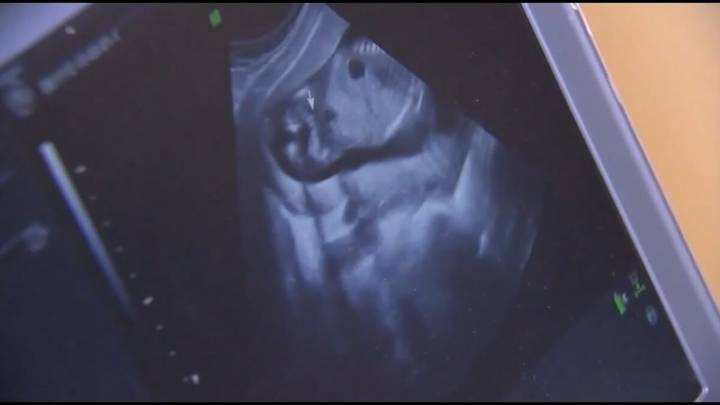 Corte vuelve a rechazar propuesta para prohibir el aborto en Missouri