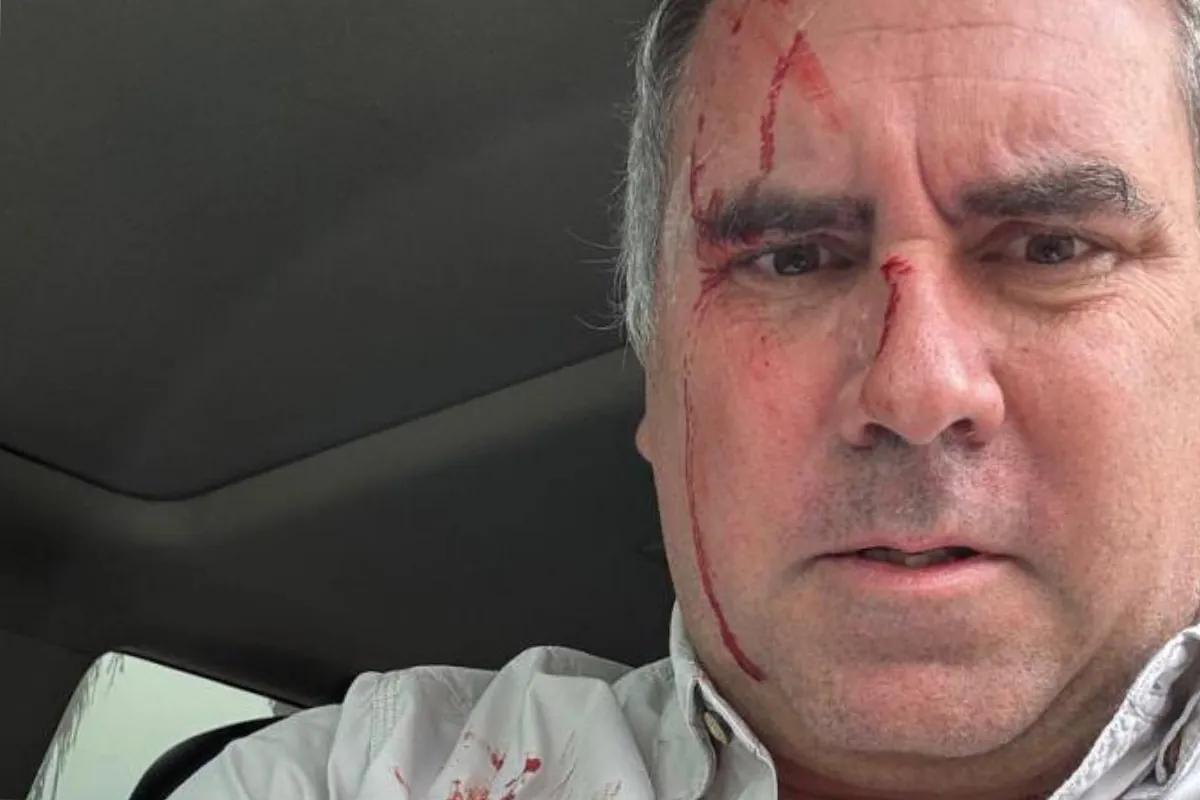 Atentado en Perú contra un candidato presidencial, que ha salido ileso