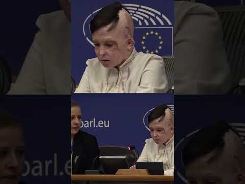 Translator SOBS While Speaking for Injured Ukrainian Boy Who Lost Mom in Russian Attack #shorts