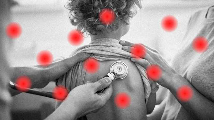 Measles outbreak in South Carolina comes as infections nationwide are already at their highest since 1992