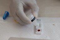 Un nuevo 'paciente Berlín': un trasplante de células madre con solo una mutación protectora logra 'borrar' el VIH en una persona con leucemia