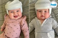 Mom Keeps Her Twin Babies in Helmets for 23 Hours a Day (Exclusive)