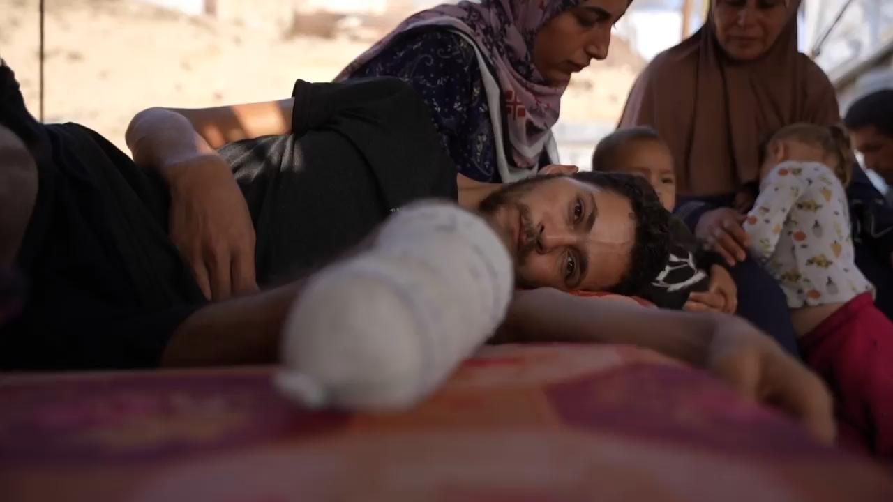 Gaza ceasefire slow to bring help for Palestinians who suffered amputations during war
