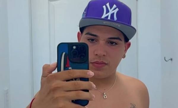 "Gracias a ellas sigo vivo": las impactantes cicatrices de Thiago Medina tras el terrible accidente en moto