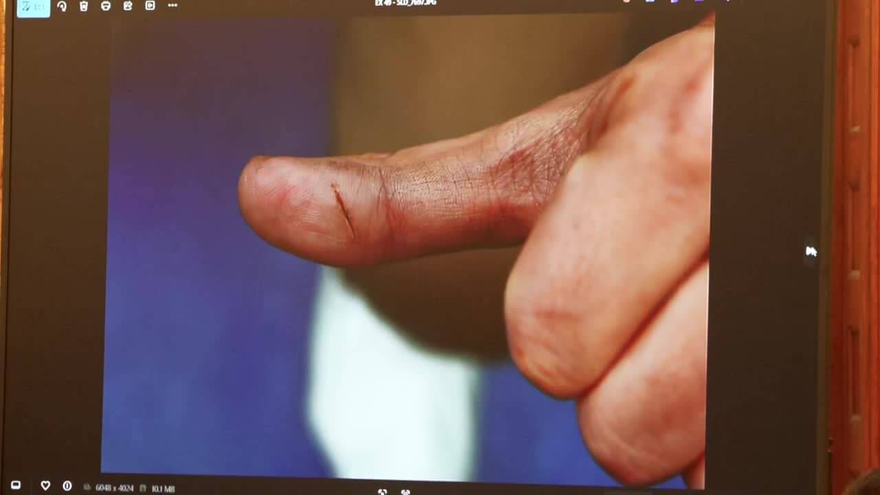 Detective Details Taking Brian Walshe Into Custody, Seeing Cut on Thumb