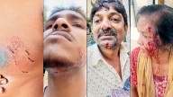 Mumbai: Stray dog bites multiple people in Goregaon West, residents live in fear