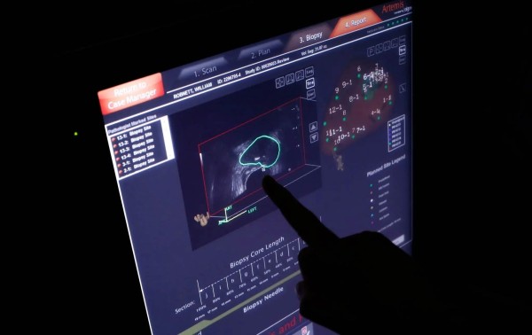 Ahora hay más diagnósticos de cáncer. Es posible que no se necesiten más tratamientos