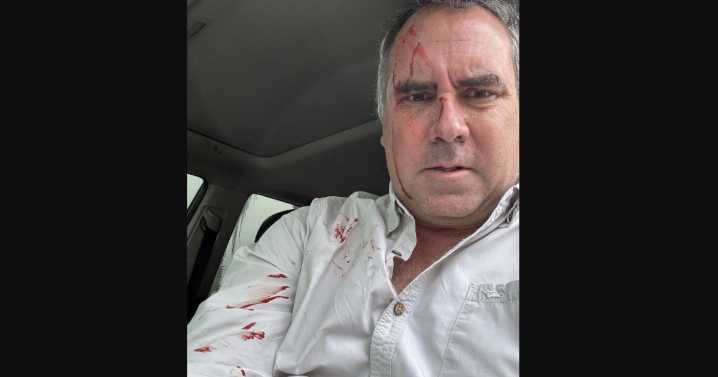 Rafael Belaúnde, precandidato presidencial de Perú, es atacado a tiros; ¿qué pasó en Lima?