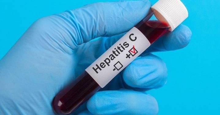 New 15-Minute Test For Hepatitis C Paves Way For Same