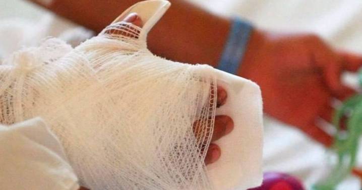 274 quemados con pólvora en Santander: 6 años de impactos devastadores