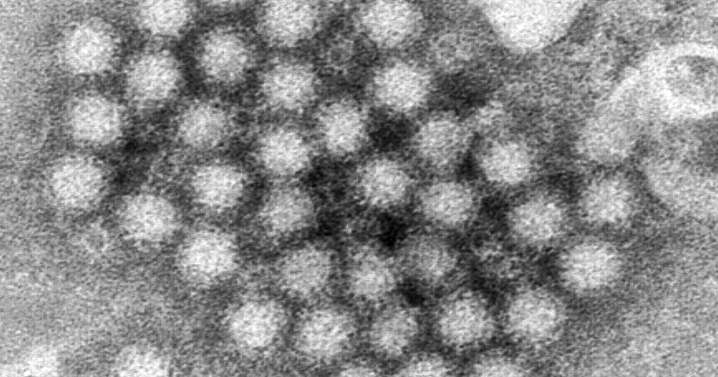 Cases of fast-moving stomach bug norovirus rise across U.S.
