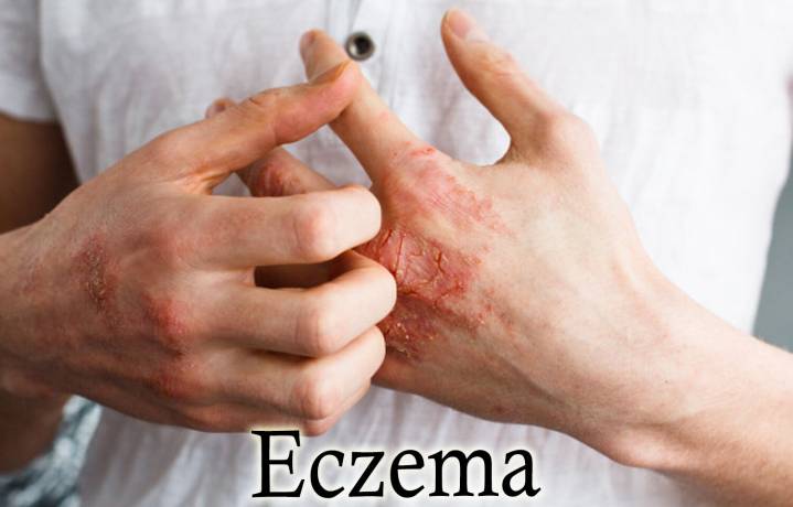 People with allergies or eczema may face higher risk of surgical complications: Study