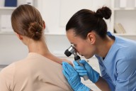 Radiación extrema en verano: Expertos llaman a reforzar la protección solar y la detección temprana del cáncer de piel